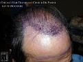Click image for larger version

Name:	Slide11.JPG
Views:	362
Size:	81.8 KB
ID:	474630