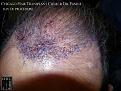 Click image for larger version

Name:	Slide13.JPG
Views:	362
Size:	96.4 KB
ID:	474632