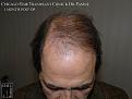 Click image for larger version

Name:	Slide16.JPG
Views:	371
Size:	58.2 KB
ID:	474635