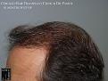 Click image for larger version

Name:	Slide24.JPG
Views:	344
Size:	81.9 KB
ID:	474643