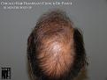 Click image for larger version

Name:	Slide25.JPG
Views:	355
Size:	64.8 KB
ID:	474644