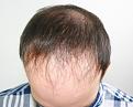 Click image for larger version

Name:	sp before chin down.jpg
Views:	445
Size:	92.0 KB
ID:	474743