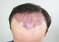 Click image for larger version

Name:	sp imm post chin down.jpg
Views:	448
Size:	90.5 KB
ID:	474747