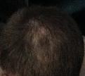 Click image for larger version

Name:	IMG_2428.JPG
Views:	479
Size:	32.3 KB
ID:	474783