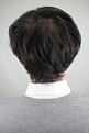 Click image for larger version

Name:	hair transplant before 2.jpg
Views:	773
Size:	92.0 KB
ID:	474831