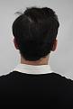 Click image for larger version

Name:	hair transplant 7 mos post 8.jpg
Views:	770
Size:	86.2 KB
ID:	474840