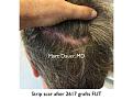 Click image for larger version

Name:	Hair Transplant Slides copy.006.jpg
Views:	341
Size:	19.0 KB
ID:	474859
