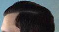 Click image for larger version

Name:	12 mos post 3.jpg
Views:	444
Size:	33.8 KB
ID:	474934
