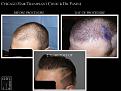 Click image for larger version

Name:	Slide3.JPG
Views:	330
Size:	69.5 KB
ID:	475047