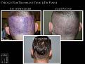 Click image for larger version

Name:	Slide5.JPG
Views:	351
Size:	78.1 KB
ID:	475049