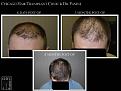 Click image for larger version

Name:	Slide6.JPG
Views:	324
Size:	60.8 KB
ID:	475050