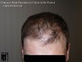 Click image for larger version

Name:	Slide17.JPG
Views:	337
Size:	53.3 KB
ID:	475061