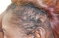 Click image for larger version

Name:	sb R profile 9 mos post.jpg
Views:	395
Size:	99.2 KB
ID:	475094