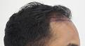 Click image for larger version

Name:	pre-op (3).JPG
Views:	447
Size:	82.1 KB
ID:	475175