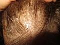 Click image for larger version

Name:	TopDryUpClose3.jpg
Views:	1282
Size:	98.0 KB
ID:	475214