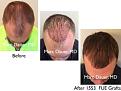 Click image for larger version

Name:	Hair Transplant Slides copy12.002.jpg
Views:	260
Size:	14.8 KB
ID:	475335