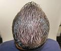 Click image for larger version

Name:	bh 18 month post chin up.jpg
Views:	552
Size:	95.1 KB
ID:	475375