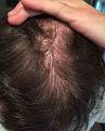 Click image for larger version

Name:	thinning further back.jpg
Views:	354
Size:	68.5 KB
ID:	475419