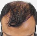 Click image for larger version

Name:	pre-op (2).JPG
Views:	432
Size:	89.9 KB
ID:	475553