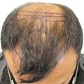 Click image for larger version

Name:	pre-op (3).jpg
Views:	429
Size:	43.4 KB
ID:	475554