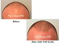 Click image for larger version

Name:	Hair Transplant Slides copy17.001.jpg
Views:	1130
Size:	11.0 KB
ID:	475582
