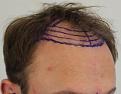 Click image for larger version

Name:	pre-op (5).JPG
Views:	424
Size:	74.1 KB
ID:	475599