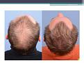 Click image for larger version

Name:	Slide4.JPG
Views:	764
Size:	59.8 KB
ID:	475651