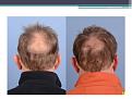 Click image for larger version

Name:	Slide5.JPG
Views:	783
Size:	51.3 KB
ID:	475652
