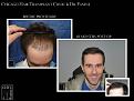 Click image for larger version

Name:	Slide1.JPG
Views:	474
Size:	56.0 KB
ID:	475806