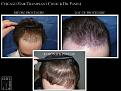 Click image for larger version

Name:	Slide5.JPG
Views:	377
Size:	75.9 KB
ID:	475810