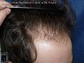 Click image for larger version

Name:	Slide12.JPG
Views:	395
Size:	83.9 KB
ID:	475817