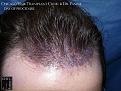 Click image for larger version

Name:	Slide16.jpg
Views:	377
Size:	93.7 KB
ID:	475821