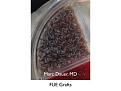 Click image for larger version

Name:	Hair Transplant Slides copy26.005.jpg
Views:	355
Size:	11.6 KB
ID:	475909