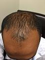 Click image for larger version

Name:	Before Crown2.jpg
Views:	481
Size:	94.1 KB
ID:	475968