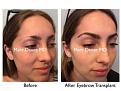 Click image for larger version

Name:	Hair Transplant Slides copy31.001.jpg
Views:	1056
Size:	17.0 KB
ID:	476012