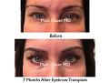 Click image for larger version

Name:	Hair Transplant Slides copy33.001.jpg
Views:	400
Size:	14.6 KB
ID:	477447