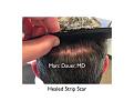 Click image for larger version

Name:	Hair Transplant Slides copy36.005.jpg
Views:	883
Size:	13.8 KB
ID:	477530