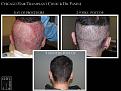 Click image for larger version

Name:	Slide6.JPG
Views:	366
Size:	75.0 KB
ID:	477575