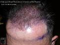 Click image for larger version

Name:	Slide10.JPG
Views:	377
Size:	92.3 KB
ID:	477579
