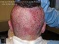 Click image for larger version

Name:	Slide13.jpg
Views:	416
Size:	92.9 KB
ID:	477582