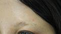 Click image for larger version

Name:	pre-op (3).JPG
Views:	365
Size:	55.7 KB
ID:	477677