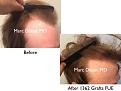 Click image for larger version

Name:	Hair Transplant Slides copy10.001.jpg
Views:	310
Size:	12.9 KB
ID:	477696