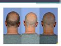 Click image for larger version

Name:	Slide8.JPG
Views:	567
Size:	58.2 KB
ID:	477858