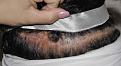 Click image for larger version

Name:	PREOP LEFT 1.jpg
Views:	458
Size:	84.8 KB
ID:	477923