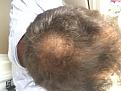 Click image for larger version

Name:	Ben Above pre-surgury.jpg
Views:	853
Size:	87.4 KB
ID:	478012