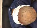 Click image for larger version

Name:	Pre surgury 4.jpg
Views:	720
Size:	85.2 KB
ID:	478024