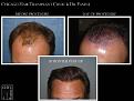 Click image for larger version

Name:	Slide2.JPG
Views:	296
Size:	65.6 KB
ID:	478082