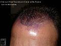Click image for larger version

Name:	Slide11.JPG
Views:	313
Size:	65.0 KB
ID:	478091
