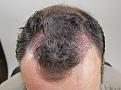 Click image for larger version

Name:	imm post chin down.jpg
Views:	343
Size:	94.6 KB
ID:	478201