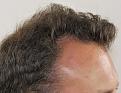Click image for larger version

Name:	ep before R profile.jpg
Views:	335
Size:	94.6 KB
ID:	478209